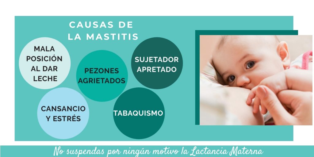 mastitis tratamiento - qué es mastitis - lactancia materna