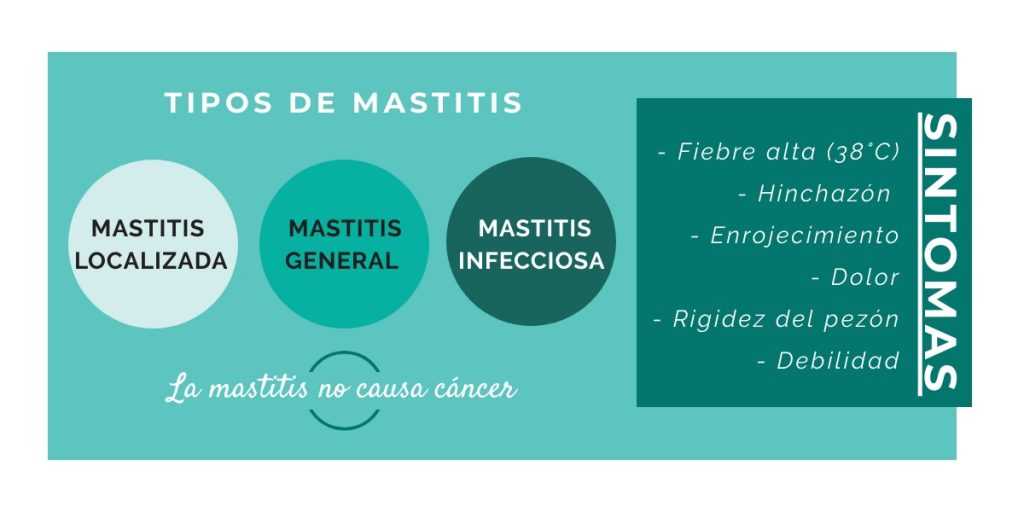 qué es mastitis - síntomas mastitis